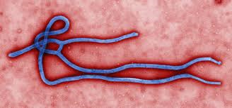 A picture of an Ebola strand.